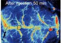 Study Finds Microplastics Block Blood Flow in Mice Brains – Impact on Health study-finds-microplastics-block-blood-flow-in-mice-brains-mpact-on-health