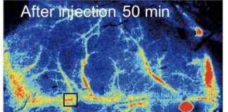 Study Finds Microplastics Block Blood Flow in Mice Brains – Impact on Health study-finds-microplastics-block-blood-flow-in-mice-brains-mpact-on-health