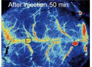 Study Finds Microplastics Block Blood Flow in Mice Brains – Impact on Health study-finds-microplastics-block-blood-flow-in-mice-brains-mpact-on-health